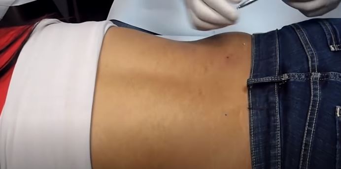 Back Dimple Piercings: Everything You Need to Know