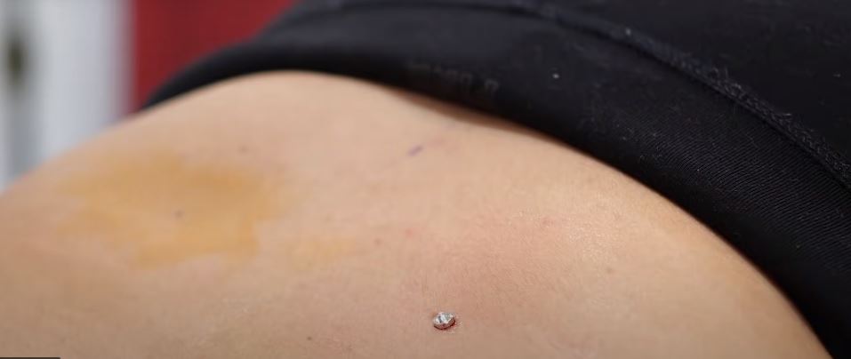 a woman is getting back piercing